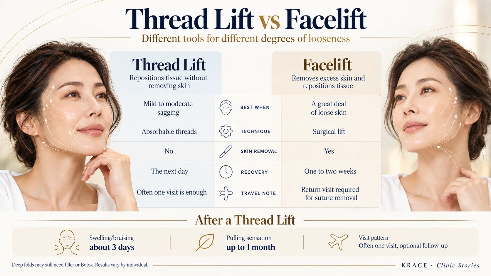 KRACE_Ep2_03_Thread_Lift_vs_Facelift-edited.webp